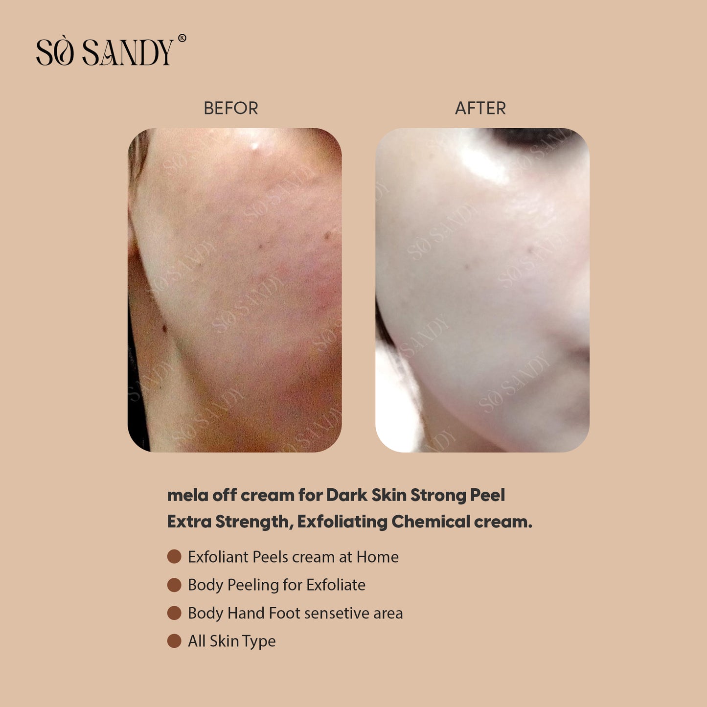 Mela Off Big Pack (3 Sessions) 15g