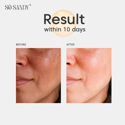 Shine & White Face Serum 30Ml